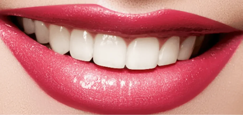Teeth whitening surface stains
