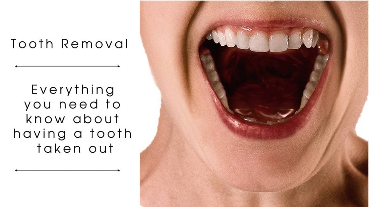 Molar teeth deals removal