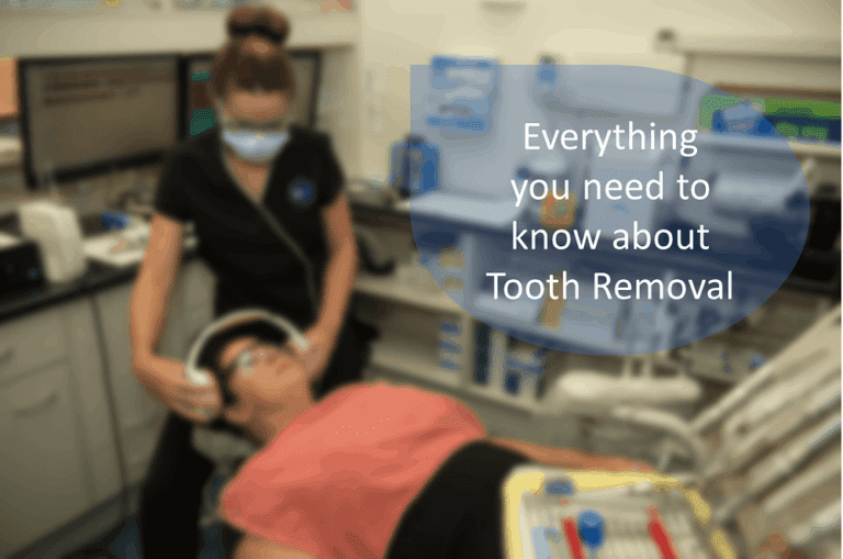 Tooth-Removal