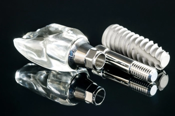 retiree dental implants bargara