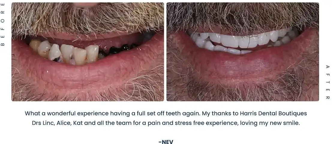 Nev After before good night dentist