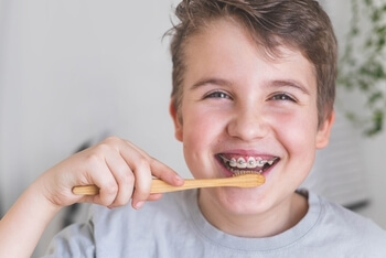 Clear Aligners vs Braces care