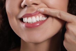 Is Fluoride Treatment Necessary gum health