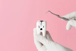 Do Porcelain Veneers Stain hide