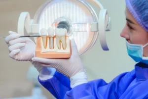 Dental Bone Graft Recovery components Dental Bone Graft Recovery components