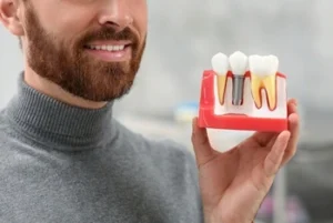 Dental Implant Cost single Dental Implant Cost single