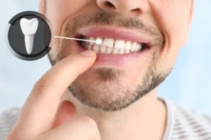 implant bone density implant bone density